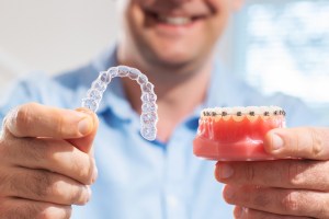 braces shown on a mold and clear retainer