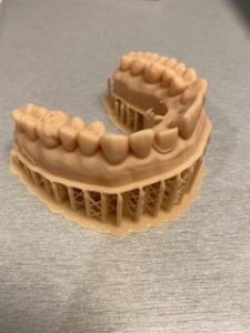 3d printed dental model