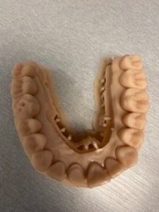 3d printer tooth model