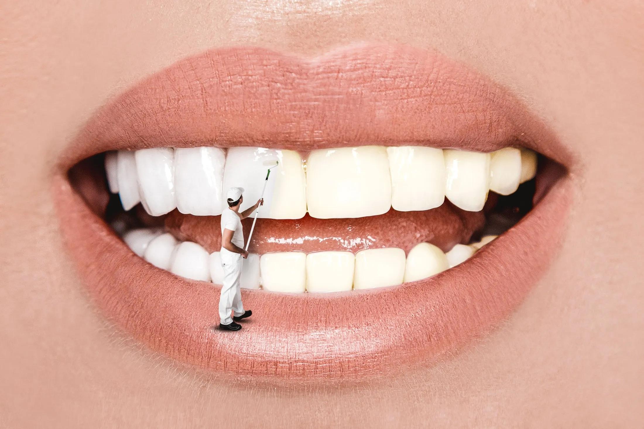 Man Whitening Teeth